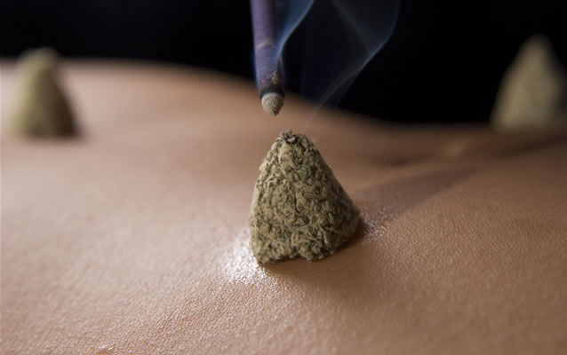 Moxibustion à Marseille (Okyu)